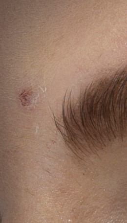 Photoshop图像处理：修复画笔示例